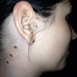 trois microdermaux nuque 250px Cette femme une cliente de Yan Dubord le Masso Perceur vient de se faire percée trois implants microdermal couleur diamant dans son cou qui monte sur son côté droigt de sa nuque et deux semaines auparavant, on peut voir son Tragus Dermal qu’elle c’était fait faire au meilleur prix à Montréal pour les piercings microdermal.