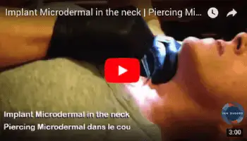 Image Thumbnail dirigeant les internautes vers YouTube pour regarder un video de Yan Dubord qui fait un perçage d'un microdermal sous le visage directement au milieu du cou.
