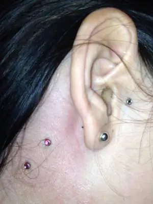 Étape 2 de 3 d'un projet piercing microdermal dans le côté de cou de cette femme dont nous voyons aussi son implant microdermal au tragus qu'elle c'est fait faire une semaine plutôt aussi par Yan Dubord Massothérapeute Perceur.