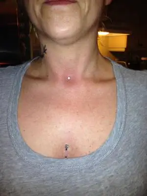 Cette photo nous montre le cou d'une femme avec dont on aperçoit deux perçages fait par Yan Dubord soit son piercing microdermal dans le devant du cou et son piercing de surface sur la poitrine avec une barbell comme bijou.