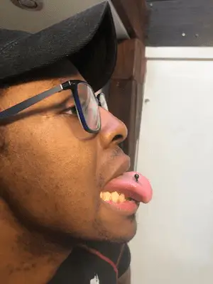 Un jeune homme la bouche ouverte avec une vue du côté droit nous montre son nouveau piercing en douceur au niveau de la langue que Yan Dubord Dubord Massotherapeute Perceur lui a fait.