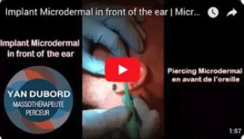 Image thumbnail d'une vidéo YouTube qui redirige les internautes vers le site YouTube pour voir un vidéo d'une super idéee de microdermal 2020 fait à côté de l'oreille et du tragus fait par Yan Dubord Massothérapeute Perceur à Montreal.