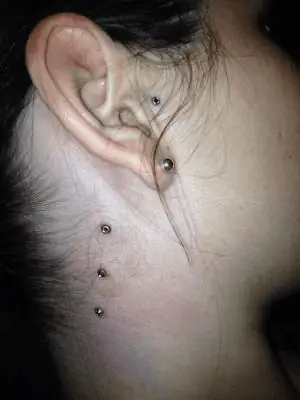 Étape 3 de 3 de ce projet de piercing microdermal dans le côté de cou de cette femme dont nous voyons aussi son implant microdermal au tragus qu'elle c'est fait faire une semaine plutôt aussi par Yan Dubord Massothérapeute Perceur.