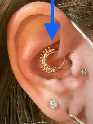 Sur cette oreille ayant quelques perçages, une flèche bleu pointe un Daith Piercing fait avec bijou en or.