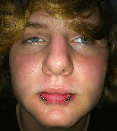 The young man with blond hair has just had his lower lip pierced on both sides of his mouth and he proudly shows us the results since he is pleased with the result and the cost of his oral piercings in Montreal.